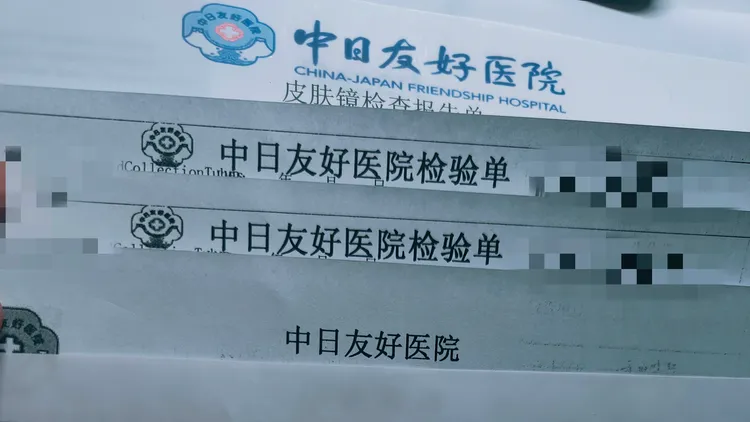 跑了三趟中日友好医院，得出比较有用的脱发治疗经验的预览图